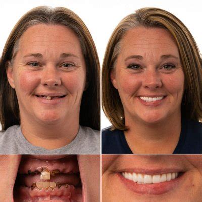 JAX Dental Implants & Dentures 